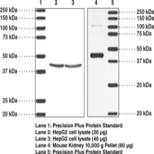 TP Receptor (human) Polyclonal Antibody
