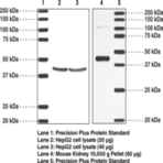 TP Receptor (human) Polyclonal Antibody