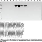 15-Lipoxygenase-2 Polyclonal Antibody