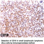 CD19 Monoclonal Antibody (Clone CB19)