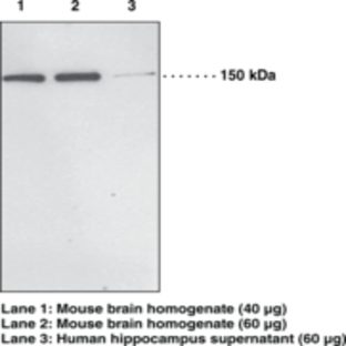 PH Domain Leucine-rich Repeat Protein Phosphatase 1 Polyclonal Antibody