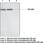 PH Domain Leucine-rich Repeat Protein Phosphatase 1 Polyclonal Antibody