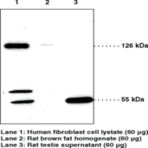 SREBP-2 Polyclonal Antibody