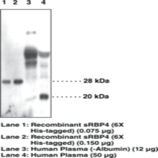 Serum Retinol Binding Protein 4 Polyclonal Antibody