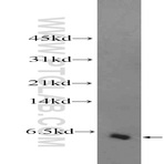 Galp-antibody-25116-1-ap-wb-10167