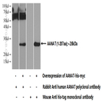 AANAT Antibody - arylalkylamine N-acetyltransferase