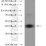VSTM1 Antibody - V-set and transmembrane domain containing 1