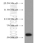 TMPRSS6 Antibody - transmembrane protease, serine 6