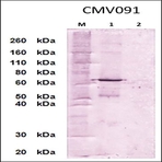 anti-Cytomegalovirus, Pp65 antibody