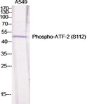 ATF-2 (phospho Ser112) Polyclonal Antibody