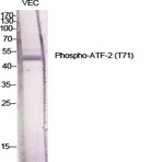 ATF-2 (phospho Thr71) Polyclonal Antibody