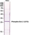 Bcl-2 (phospho Ser70) Polyclonal Antibody