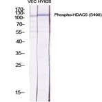 HDAC5 (phospho Ser498) Polyclonal Antibody