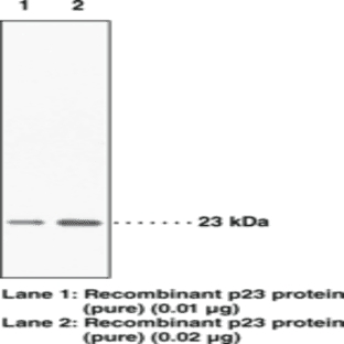 Prostaglandin E Synthase (cytosolic, FL) Polyclonal Antibody avatar
