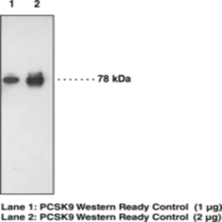 PCSK9 Monoclonal Antibody (Clone 15A6) avatar