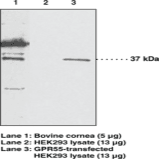 GPR55 Polyclonal Antibody