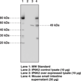 IP6K2 Monoclonal Antibody (Clone 4F10) avatar