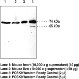 PCSK9 Polyclonal Antibody avatar