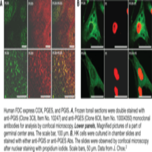 Prostaglandin I Synthase Monoclonal Antibody (Clone 3C8) avatar