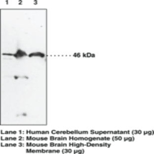 NAPE-PLD Polyclonal Antibody (aa 6-20) avatar