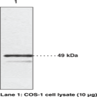 Chemokine-Like Receptor 1 Polyclonal Antibody avatar