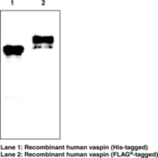 Vaspin (human) Monoclonal Antibody (Clone VP63) avatar