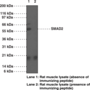 SMAD2 Polyclonal Antibody