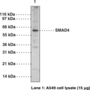 SMAD4 Polyclonal Antibody