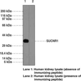 SUCNR1 Polyclonal Antibody avatar