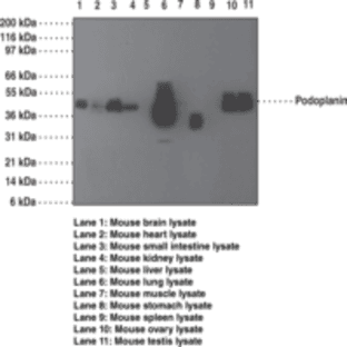 Podoplanin Monoclonal Antibody (Clone pmab-1) avatar