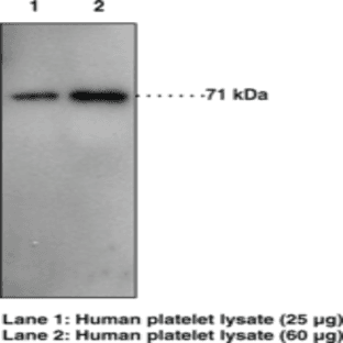 Prostaglandin Transporter (C-Term) Polyclonal Antibody avatar