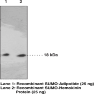 SUMO Monoclonal Antibody avatar