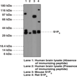 S1P5 Polyclonal Antibody avatar