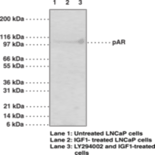 Androgen Receptor (Phospho-Ser210,213) Monoclonal Antibody (Clone 156C135.2) avatar