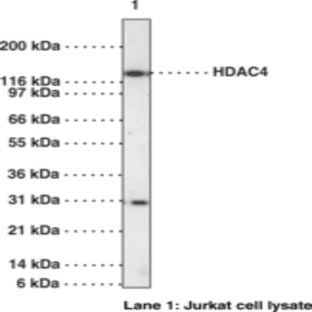 HDAC4 Polyclonal Antibody avatar