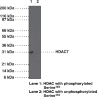 HDAC7 (Phospho-Ser155) Polyclonal Antibody avatar