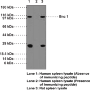 Bnc 1 Polyclonal Antibody avatar