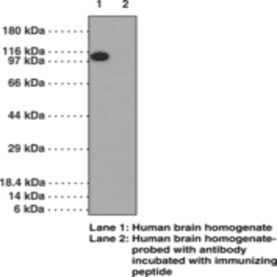 LSD1 Polyclonal Antibody (aa 100-150)