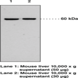Soluble Epoxide Hydrolase (FL) Polyclonal Antibody avatar