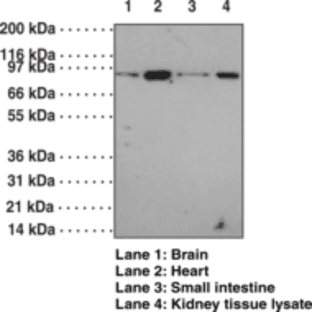 Toll-Like Receptor 12 Polyclonal Antibody avatar