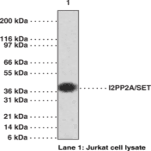 I2PP2A/SET Polyclonal Antibody avatar