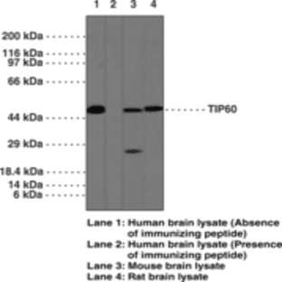 TIP60 Polyclonal Antibody avatar