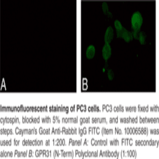 GPR31 (N-Term) Polyclonal Antibody avatar