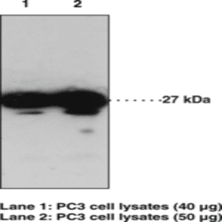 GPR31 (C-Term) Polyclonal Antibody avatar