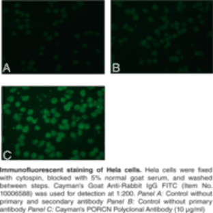 PORCN Polyclonal Antibody avatar