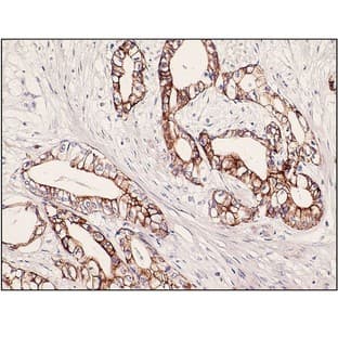 Cytokeratin 7 (DB 051)