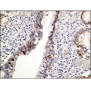 p53 (DB 026)