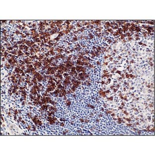 CD5 (DB 027)