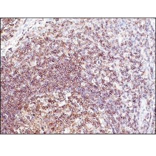 CD45 (DB 042) avatar