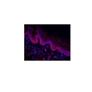 Lectins